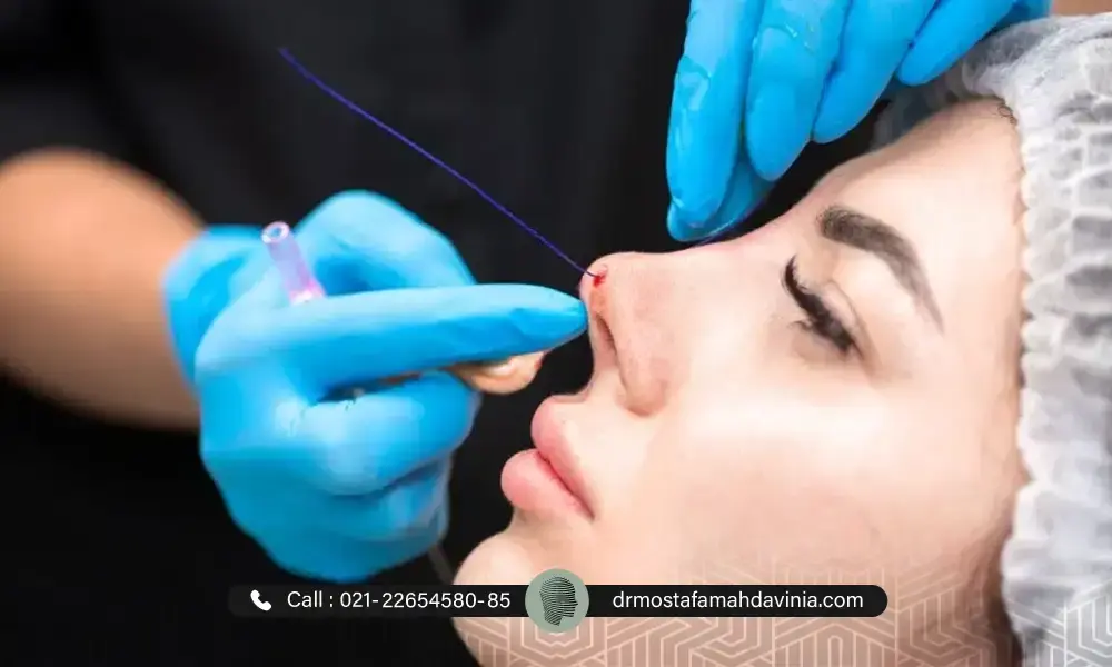 فرم جوان صورت