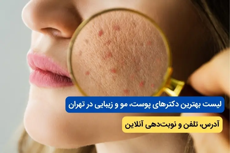 پوست
