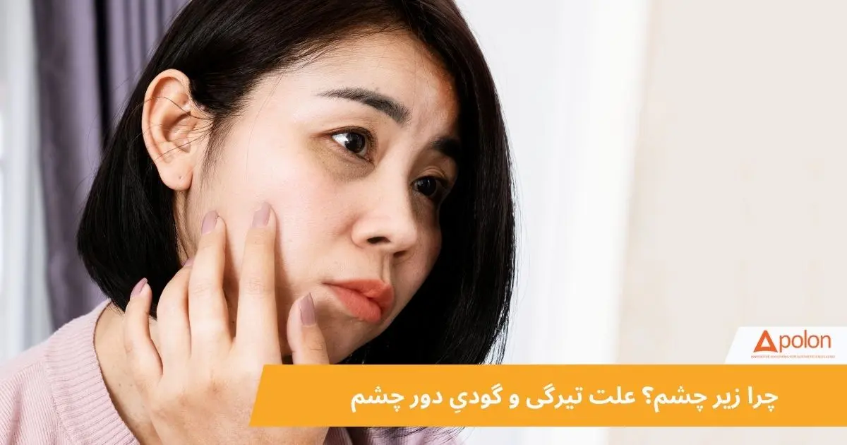 کربوکسی تراپی زیر چشم