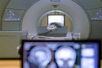 تولید نانوکامپوزیت پلیمری دوکاره برای تصویربرداری MRI و درمان سرطان