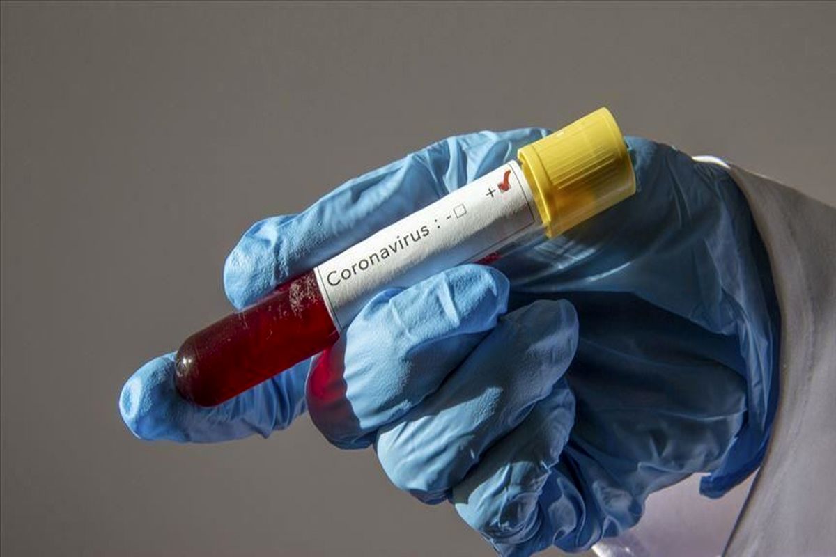Zionist Regime Health Minister tested positive for coronavirus