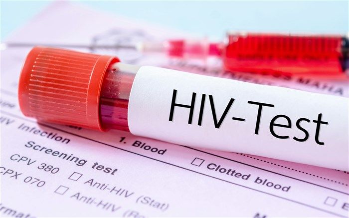 بیماری HIV در کشور چند نفر هستند؟