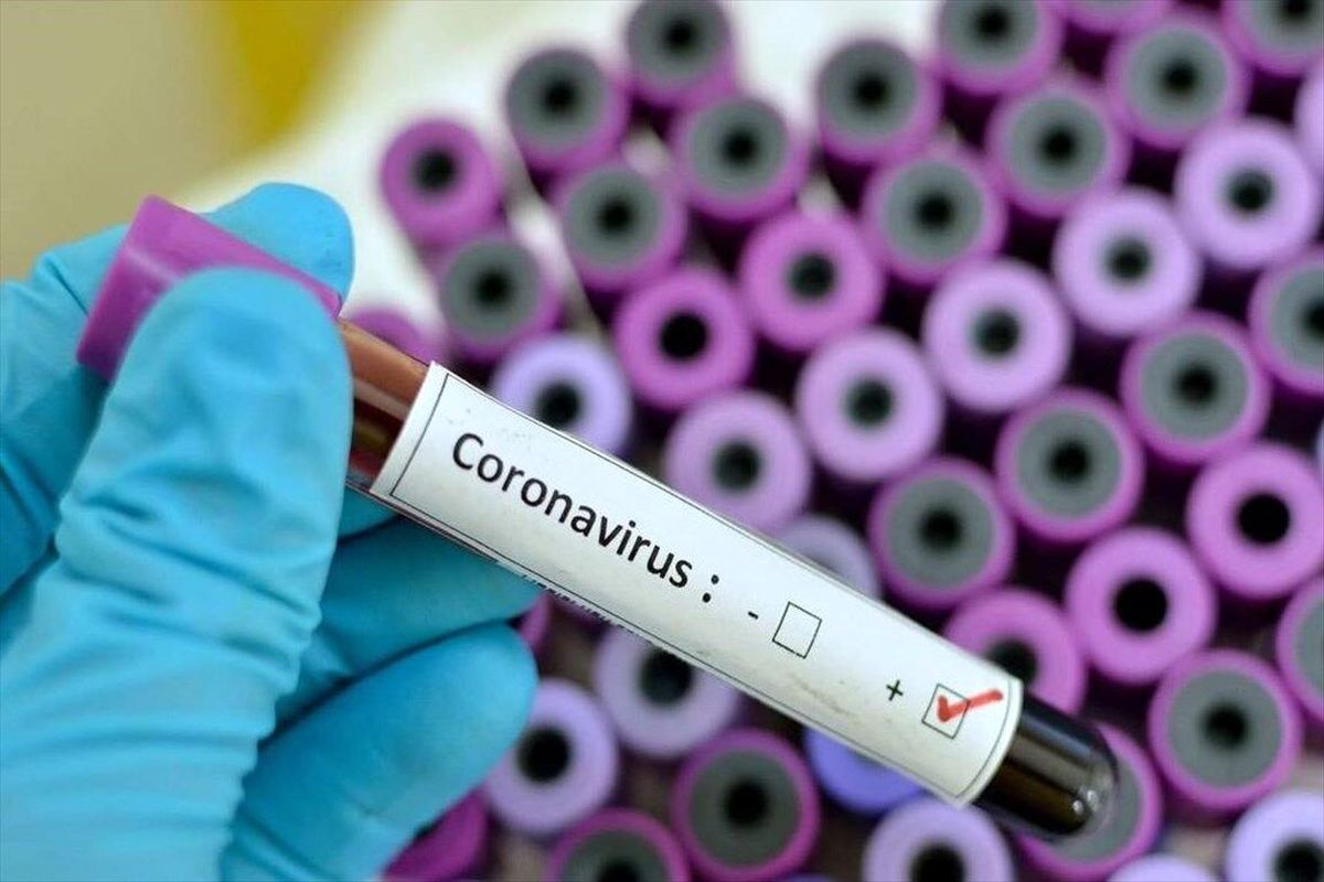 آزمایش کرونا ۴۵ نفر در ۲۴ ساعت گذشته در یزد مثبت اعلام شد