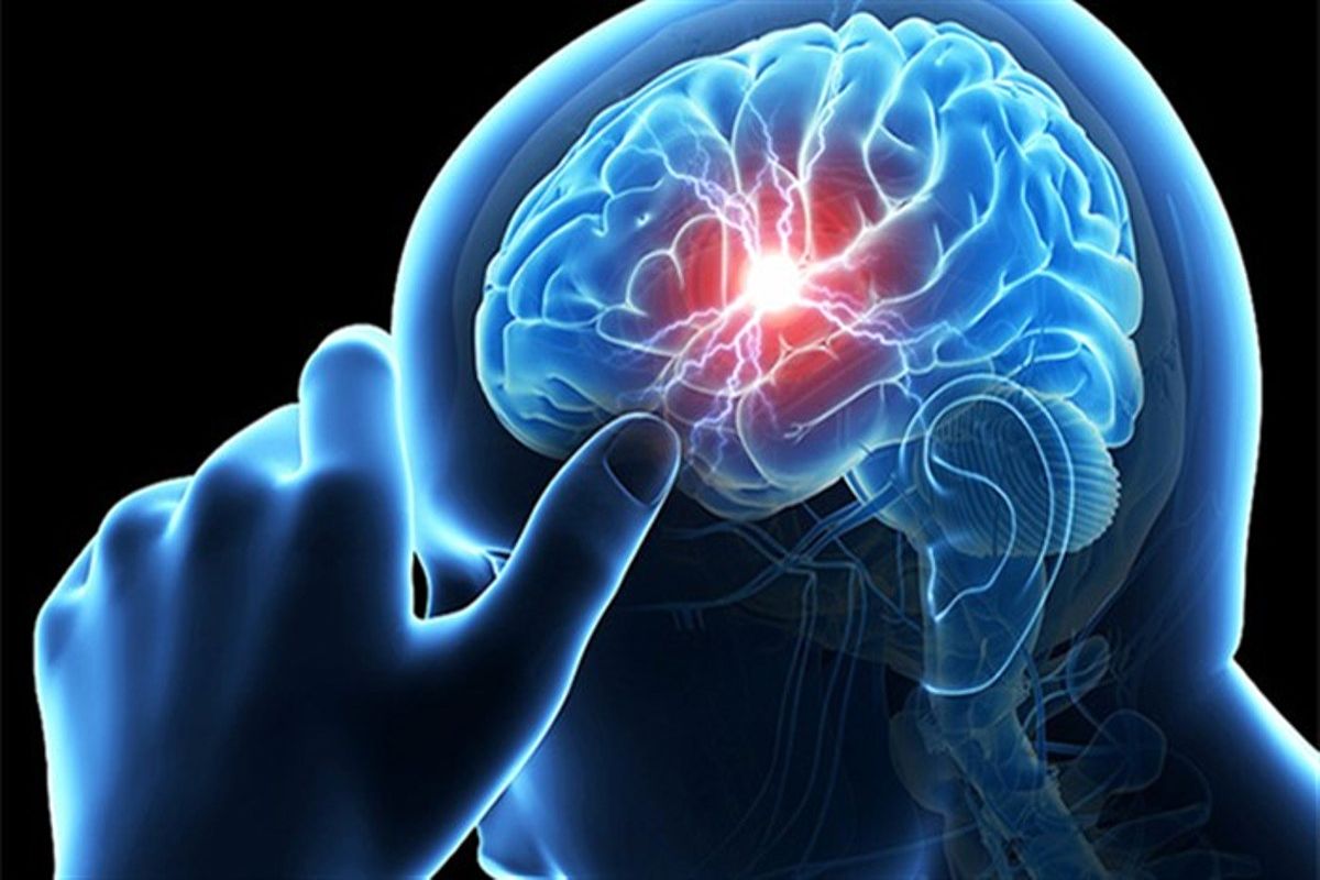 نشانه‌های سکته مغزی چیست؟
