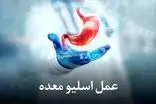 هزینه عمل اسلیو معده با بیمه تکمیلی | شرایط و میزان پوشش بیمه ‌های مختلف