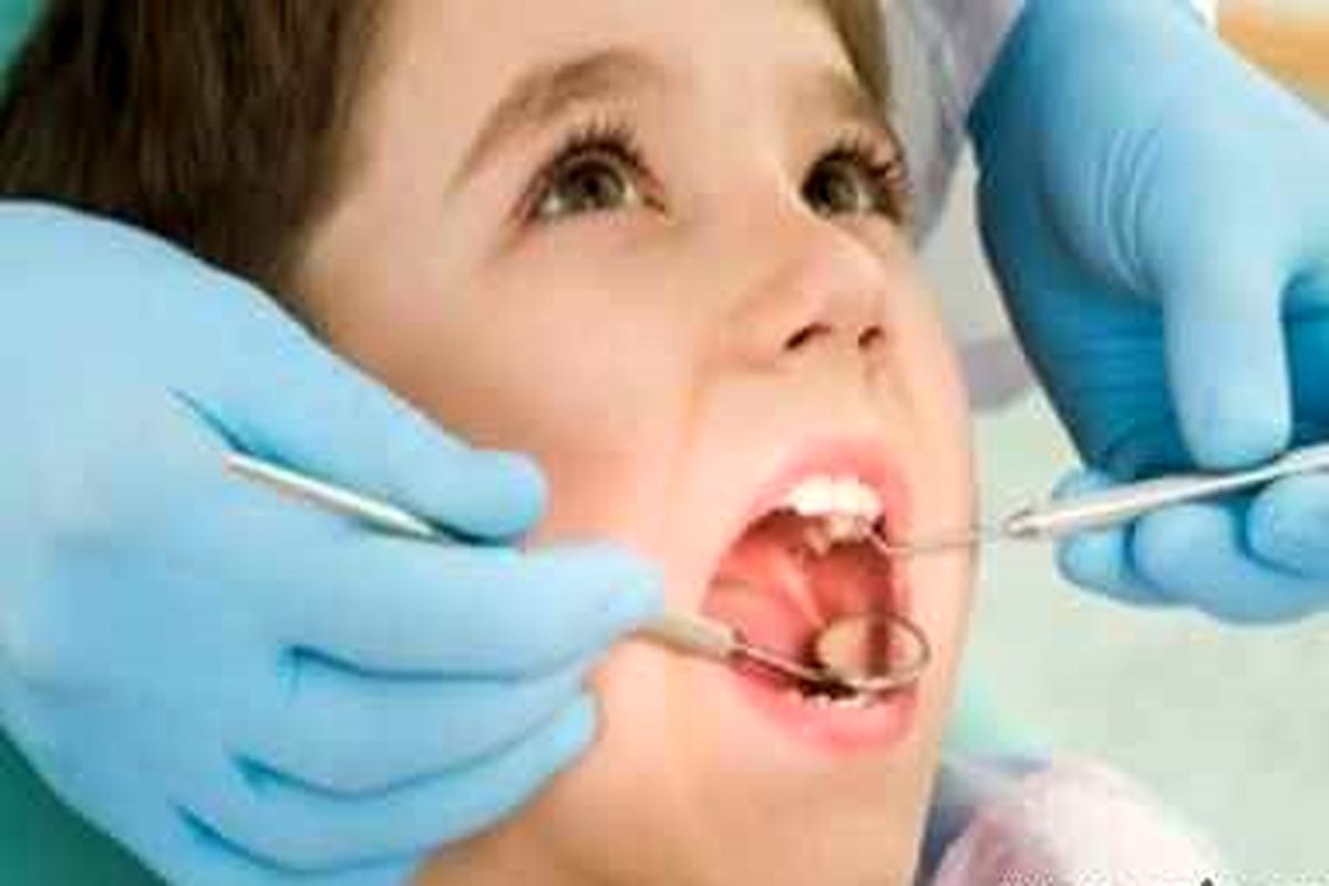  مهم‌ترین راه‌های پیشگیری از پوسیدگی دندان‌ها