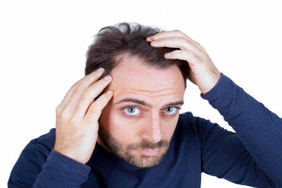علت چربی مو سر چیست؟/ راه های جلوگیری از چرب شدن مو