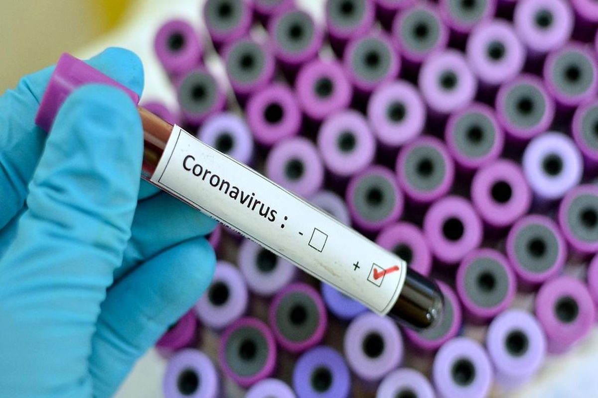 شناسایی 5 ابتلای جدید به ویروس کرونا در منطقه کاشان/ بدون فوتی