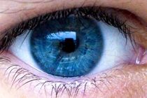 لکه های زرد درون چشم چه عوارضی به دنبال دارد؟