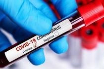 شناسایی 21 ابتلای جدید به ویروس کرونا در منطقه کاشان/ بدون فوتی