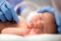 جراحی نوزاد ۵۰ روزه در بیمارستان ۱۷ شهریور رشت