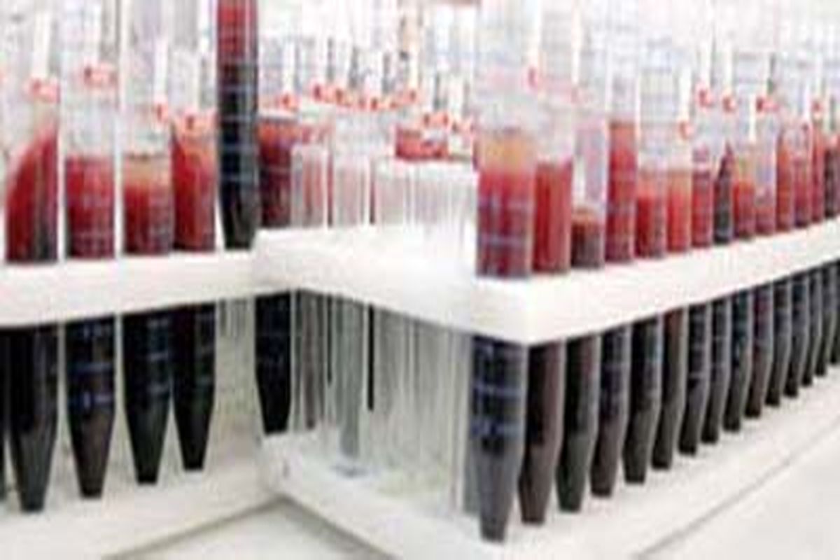 ذخیره ۲۰هزار نمونه خون بندناف در بانک‌های عمومی