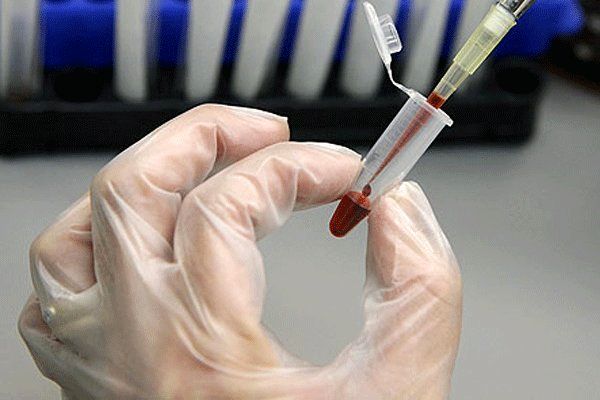 ۶۵ هزار نمونه در بانک خون بند ناف پژوهشگاه رویان