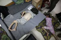 مدیر کل وزارت بهداشت فلسطین به  سوء تغذیه در غزه واکنش نشان داد