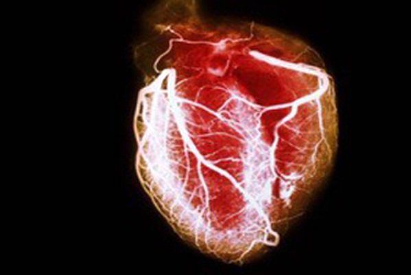 تلاش های جدید در حیطه مهندسی زیست پزشکی برای بهبود ترمیم قلب