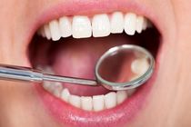 فریب بیمه‌های تقلبی دهان و دندان را نخورید