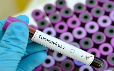 اعلام آمادگی موسسه رازی برای مقابله با ویروس کرونا