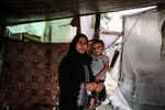 حدود ۱۵۰ هزار زن باردار در غزه با شرایط بهداشتی وخیم مواجه هستند
