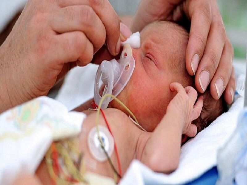 درمان «رتینوپاتی نارسی» از نابینایی ۲۸۰ نوزاد در فارس پیشگیری کرد