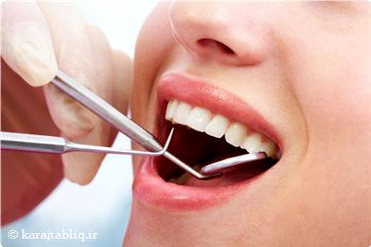 بیمه ها زیر بار تامین هزینه های دندانپزشکی نمی روند