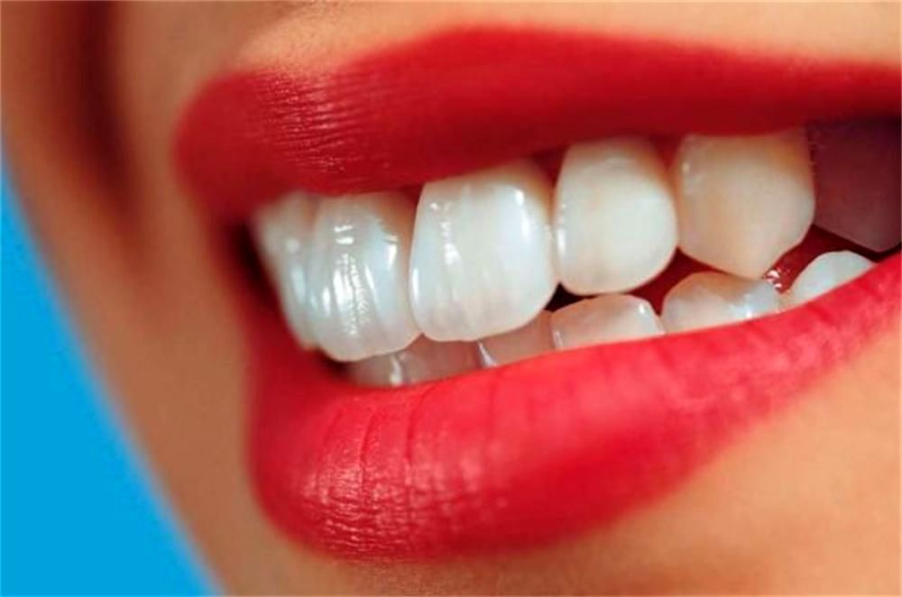 مشاهده دندان های اصلاح شده پیش از جراحی