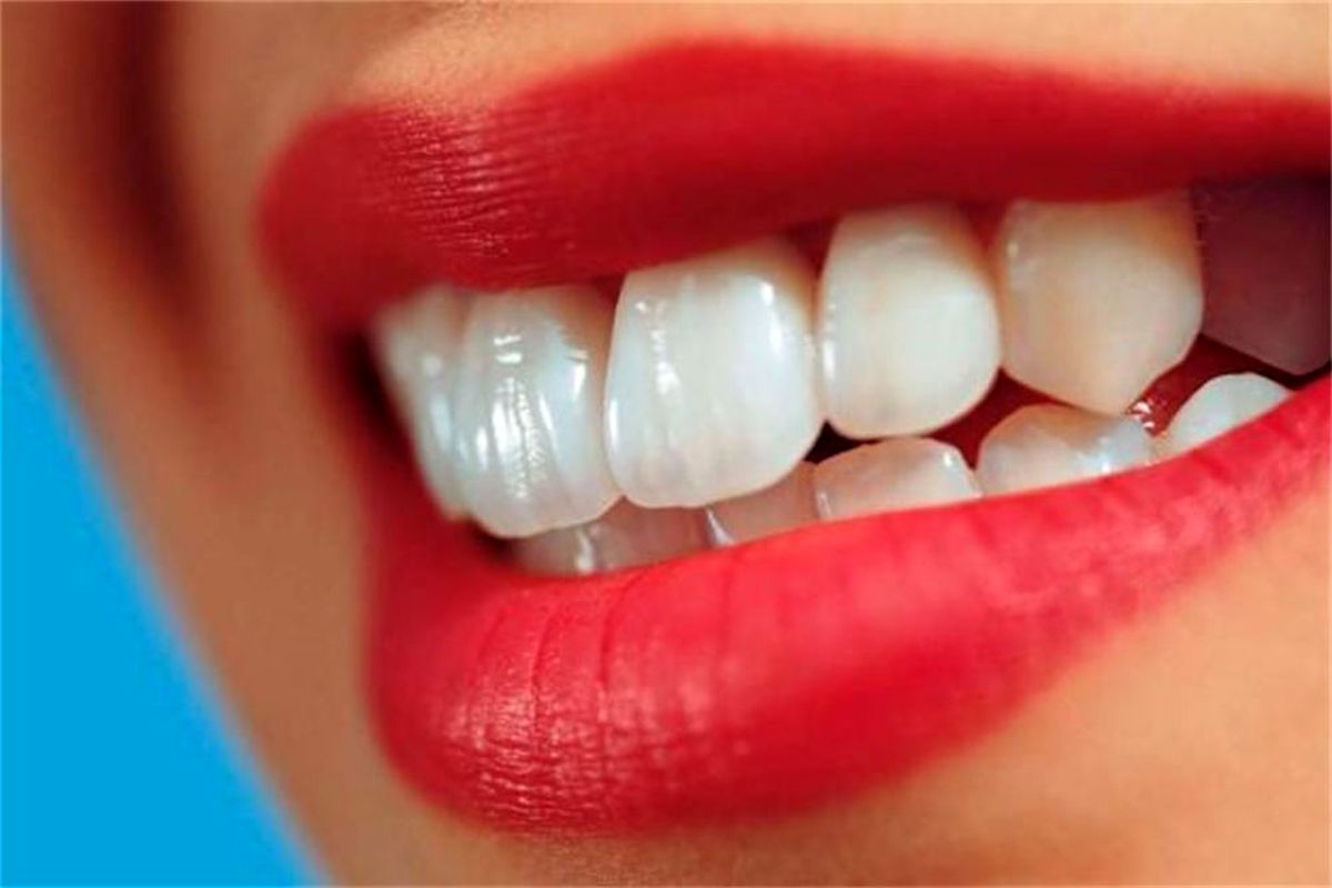 سفیدکننده‌های طبیعی دندان کدامند؟