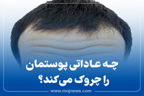 اینفوگرافیک/ چه عاداتی پوستمان را چروک می کند؟