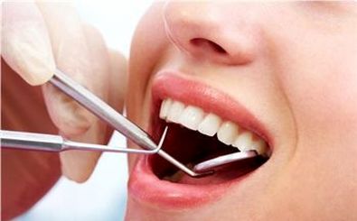 روش‌های زیباسازی دندان‌ها/ گرایش مردم به داشتن دندان‌های زیبا افزایش یافته است