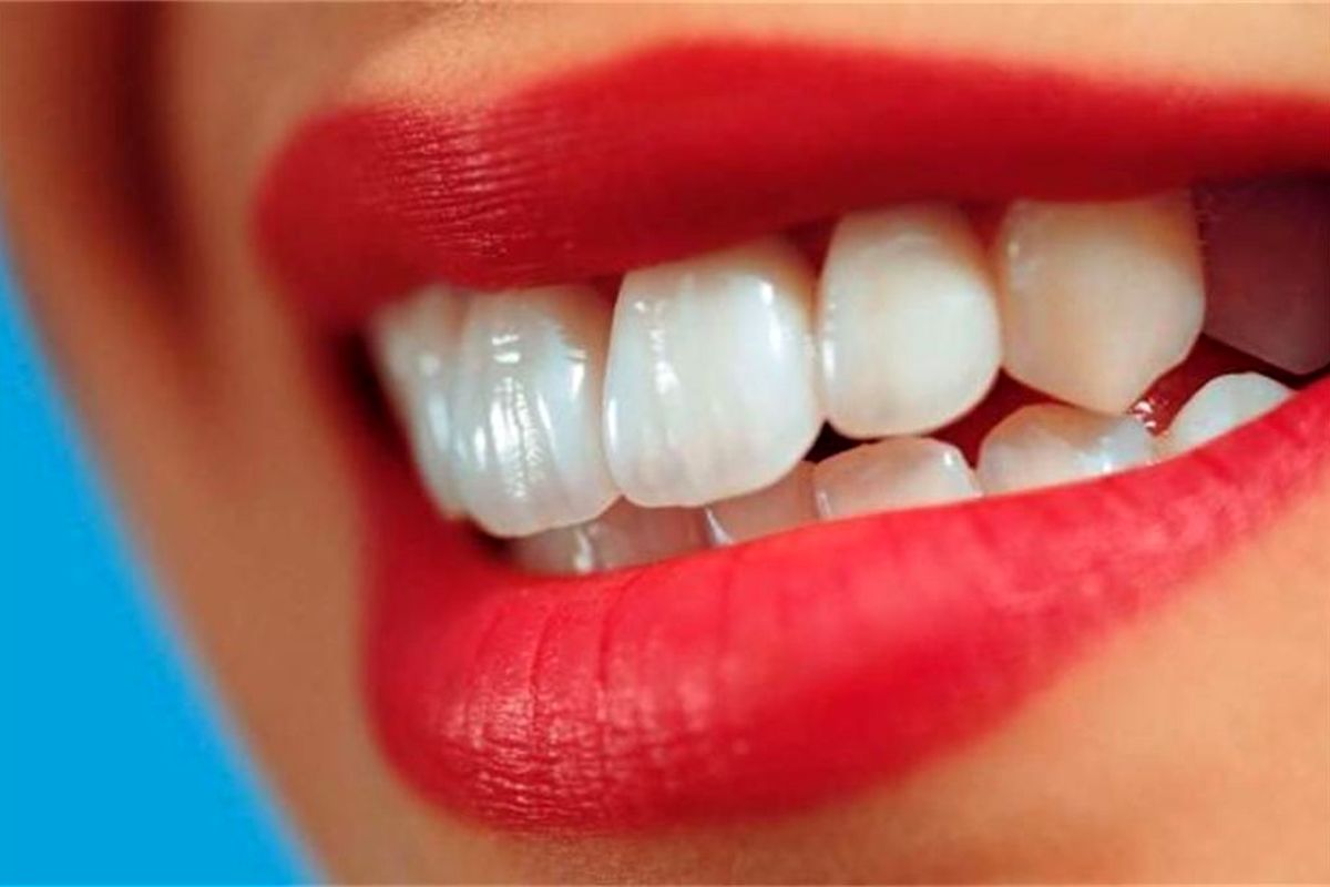 دندان‌ها کمبود ویتامین D را نشان می‌دهند