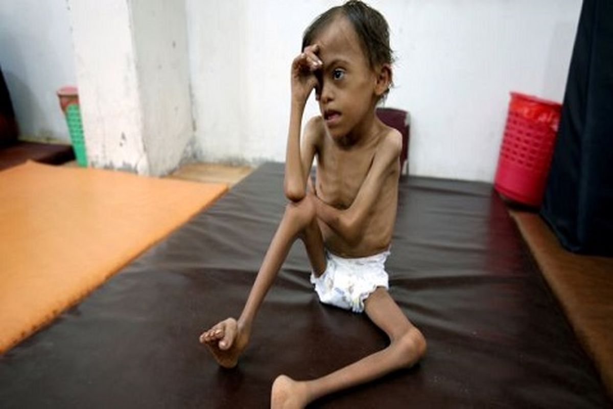 ۶۶ درصد یمنی‌ها هیچ غذایی برای خوردن ندارند