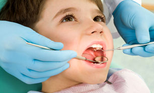 کاهش میزان پوسیدگی دندان های دانش‌آموزان ۱۲ ساله کشور