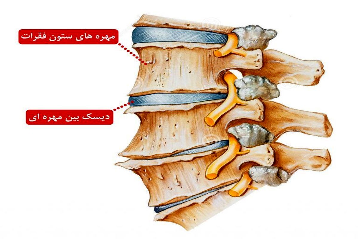 داربست ژلاتینی بین ستون فقرات ساخته شد