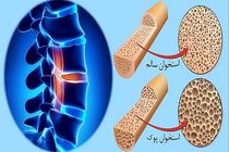 چه افرادی در معرض خطر بروز پوکی استخوان هستد؟