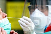 نرخ تست PCR کرونا در بخش دولتی و خصوصی اعلام شد