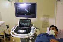 راه اندازی تنها دستگاه اکوکاردیوگرافی سه بعدی غرب کشور در بیمارستان فرشچیان همدان