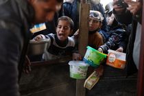 Malnutrition is the most important problem of Gaza children 