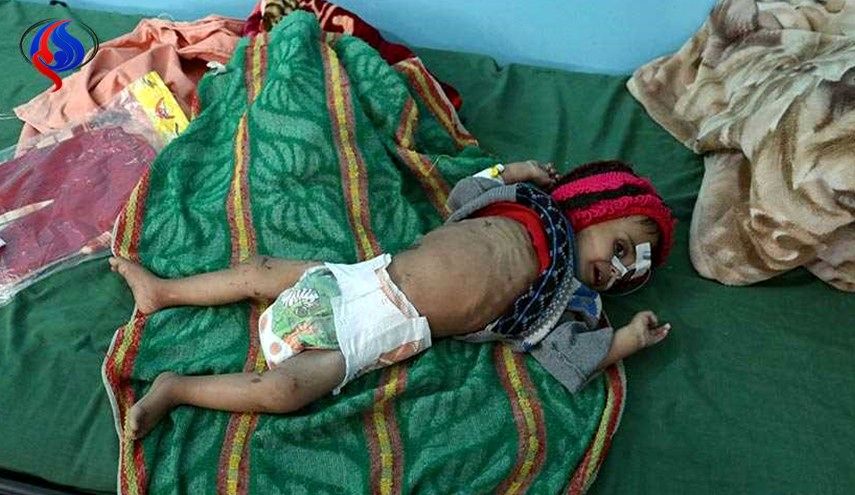 هر 10 دقیقه یک کودک یمنی می‌میرد