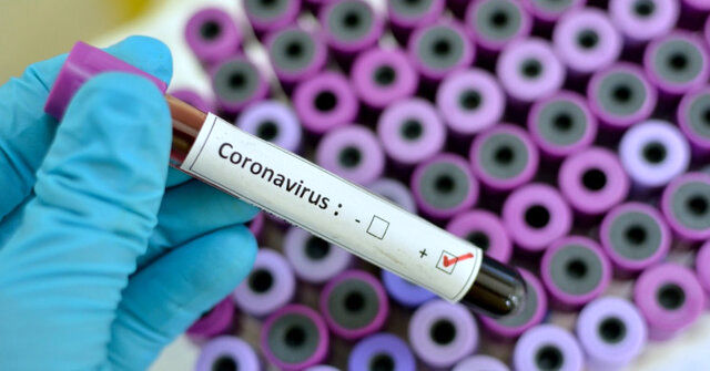 آزمایش مثبت به ویروس کرونا در اصفهان نداشته‌ایم