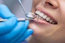 دندانپزشکان ایرانی جزء چند کشور اول جهان هستند 