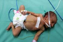 فوت شمار زیادی از نوزادان نارس در بیمارستان شفا