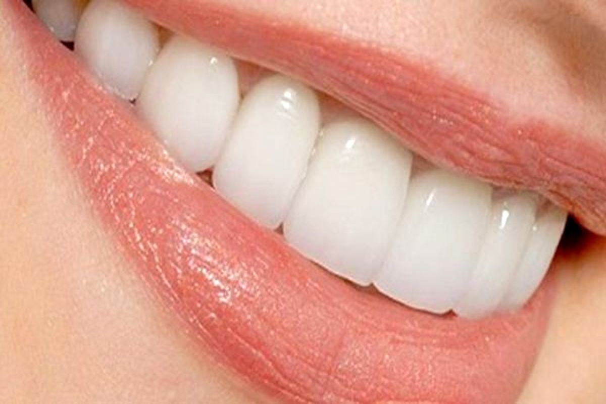 غیر بهداشتی بودن پودر سفید کننده دندان با نام تجاری "والنسی"