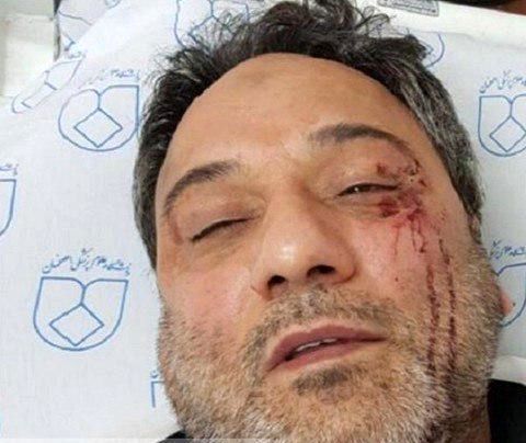 بازداشت فرد مهاجم به پزشک و پرستار بیمارستان فارابی اصفهان