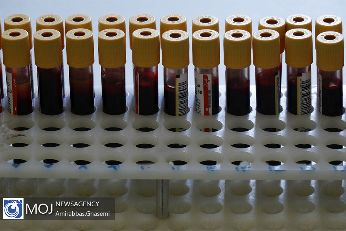 آغاز طرح پژوهشی تزریق پلاسمای خون بیماران بهبودیافته کرونا به بیماران درگیر در همدان