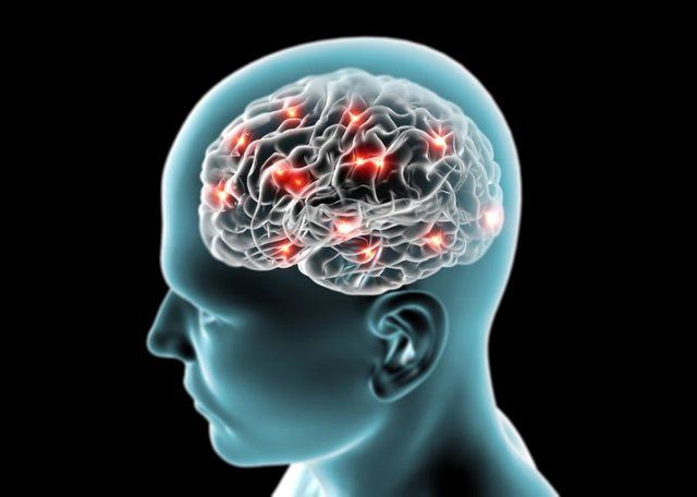 مغز بیماران مبتلا به آلزایمر باکتری بیشتری دارد