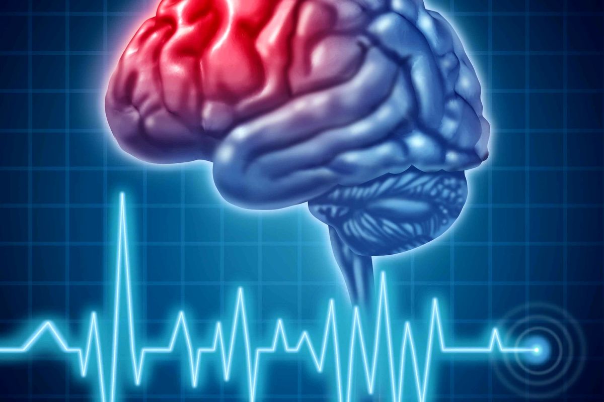 سکته مغزی از قابل درمان ترین بیماری های بشر است