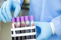 شناسایی 3 ابتلای جدید به ویروس کرونا در اردستان