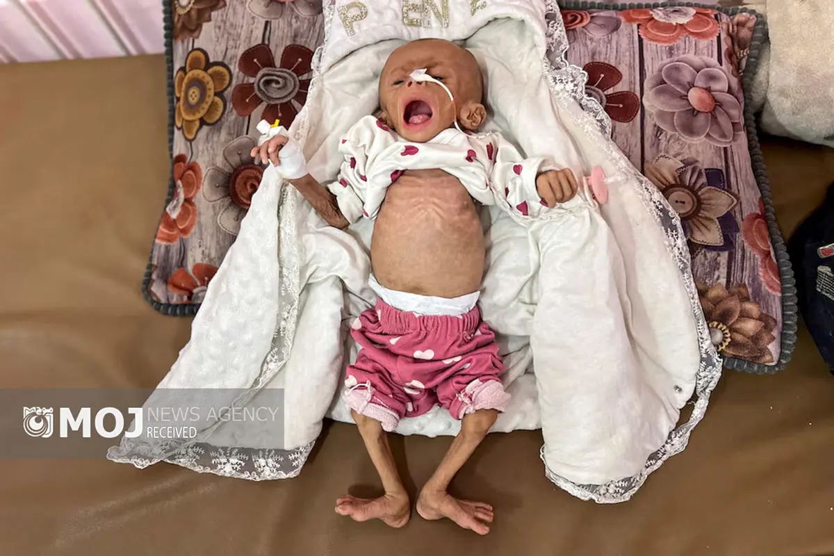 ۲۴۰۰ کودک غزه در خطر مرگ از گرسنگی هستند