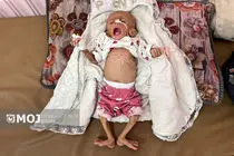 ۲۴۰۰ کودک غزه در خطر مرگ از گرسنگی هستند