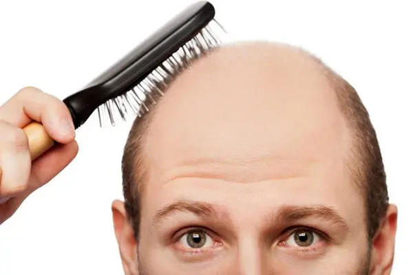 طاس‌ترین کشورهای جهان را بشناسید