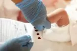 آشنایی با بهترین زمان غربالگری نوزادان و جنین